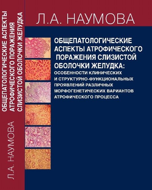 Общепатологические аспекты атрофического поражения слизистой оболочки желудка: особенности клинических и структурно -функциональных проявлений различных морфогенетических вариантов атрофического проце