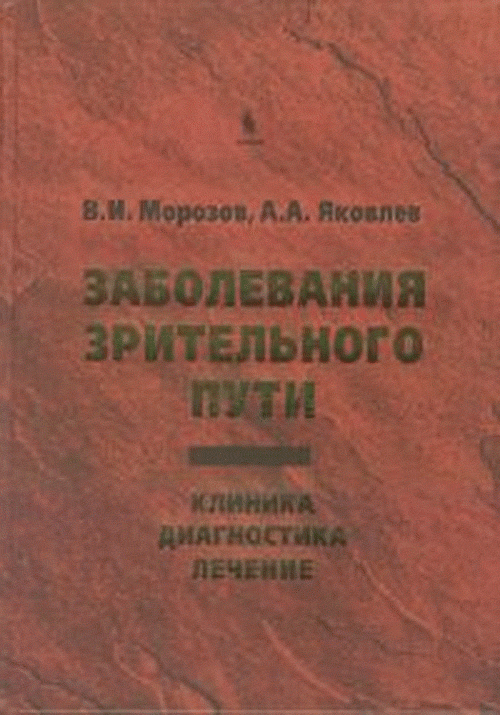 Заболевания зрительного пути: Клиника. Диагностика. Лечение. Морозов В.И., Яковлев А. А.
