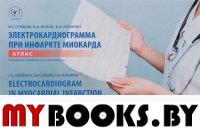 Электрокардиограмма при инфаркте миокарда. Атлас (на русс.  и англ. яз. ). Гордеев И.,Воло