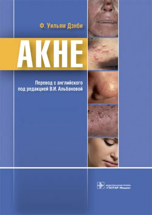 Акне. Дэнби,Ф.Уильям
