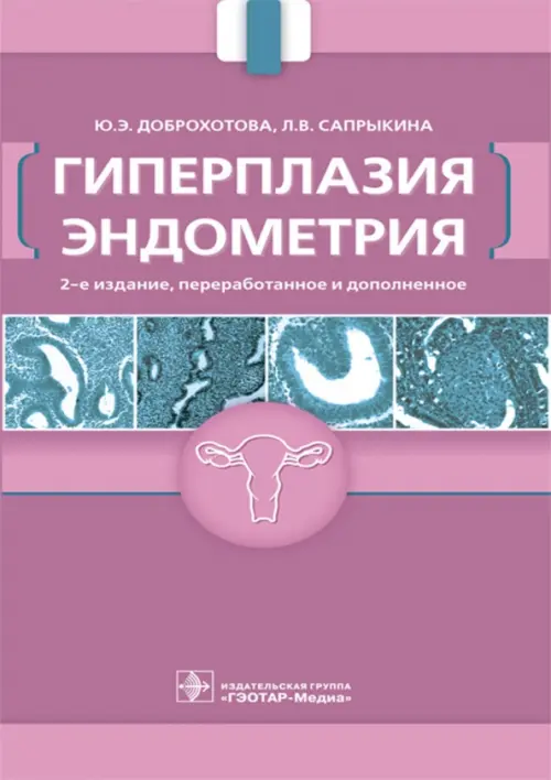 Гиперплазия эндометрия. 3-е изд., перераб. и доп. Доброхотова Ю.Э., Сапрыкина Л.В.
