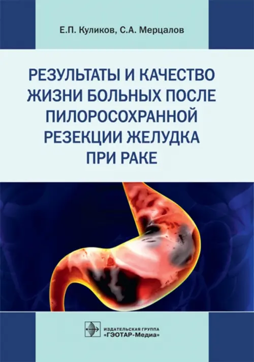 Результаты и качество жизни больных после пилоросохранной резекции желудка при раке. Мерцалов Сергей Александрович