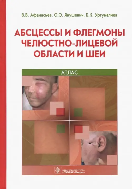 Абсцессы и флегмоны челюстно-лицевой области и шеи. Афанасьев В. и