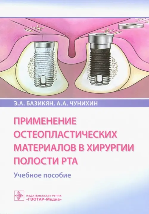 Применение остеопластических материалов в хирургии полости рта: Учебное пособие. Базикян Э.А., Чунихин А.А