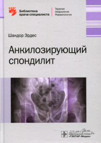 Анкилозирующий спондилит. Эрдем Ш.