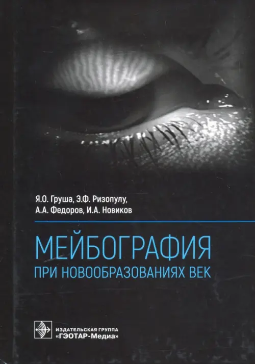 Мейбография при новообразованиях век. Груша Ярослав Олегович