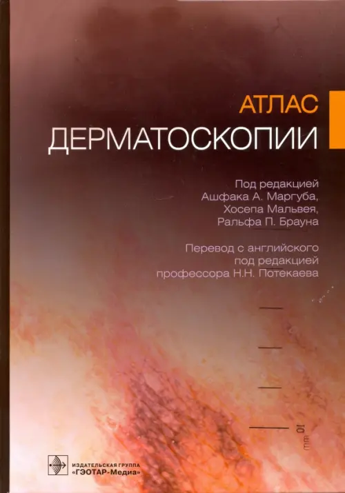 Атлас дерматоскопии. под ред.Ашфака