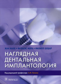 Наглядная дентальная имплантология. Мале Ж.