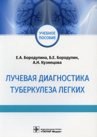 Лучевая диагностика туберкулеза легких. Бородулина Е.,Б