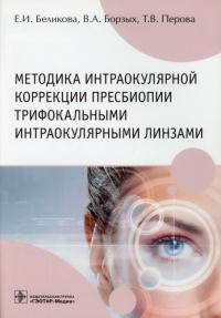 Методика интраокулярной коррекции пресбиопии трифокальными интраокулярными линза. Беликова Е.,Бор