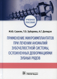 Применение микроимплантатов при лечении аномалий зубочелюст. системы, осложнен. деф. Саакян М.,Зубар