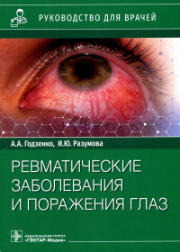 Ревматические заболевания и поражения глаз. Руководство для врачей