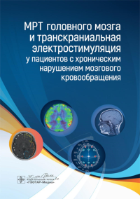 МРТ головного мозга и транскраниальная электростимуляц. у пациентов с хронич. нару. Морозова Т.,Бор