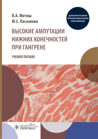 Высокие ампутации нижних конечностей при гангрене. Митиш В.,Пасхал