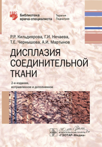 Дисплазия соединительной ткани. Кильдиярова Р.,