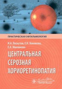 Центральная серозная хориоретинопатия. Лоскутов И.,и д