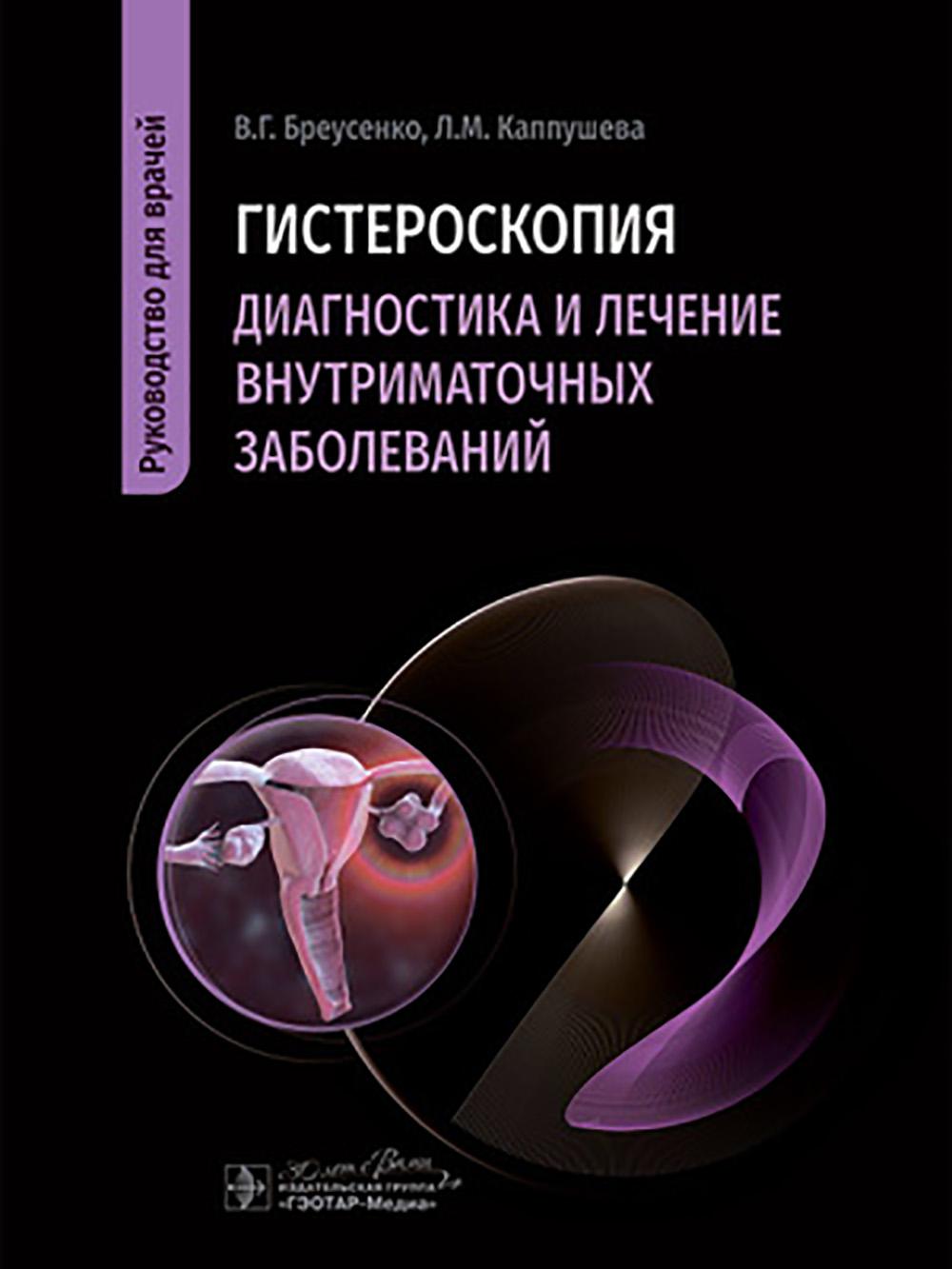 Гистероскопия. Диагностика и лечение внутриматочных заболеваний: руководство для врачей