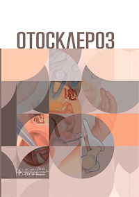Отосклероз. Крюков А.,Янов