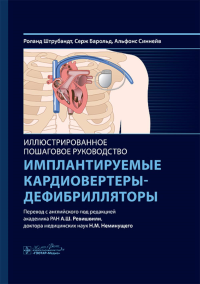 Имплантируемые кардиовертеры-дефибрилляторы. Иллюстрированное пошаговое руководство. Барольд С., Штрубандт Р., Синнейв А.