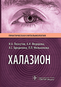 Халазион. Лоскутов И.,и д