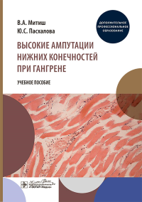 Высокие ампутации нижних конечностей при гангрене: Учебное пособие. Митиш В.А., Пасхалова Ю.С.