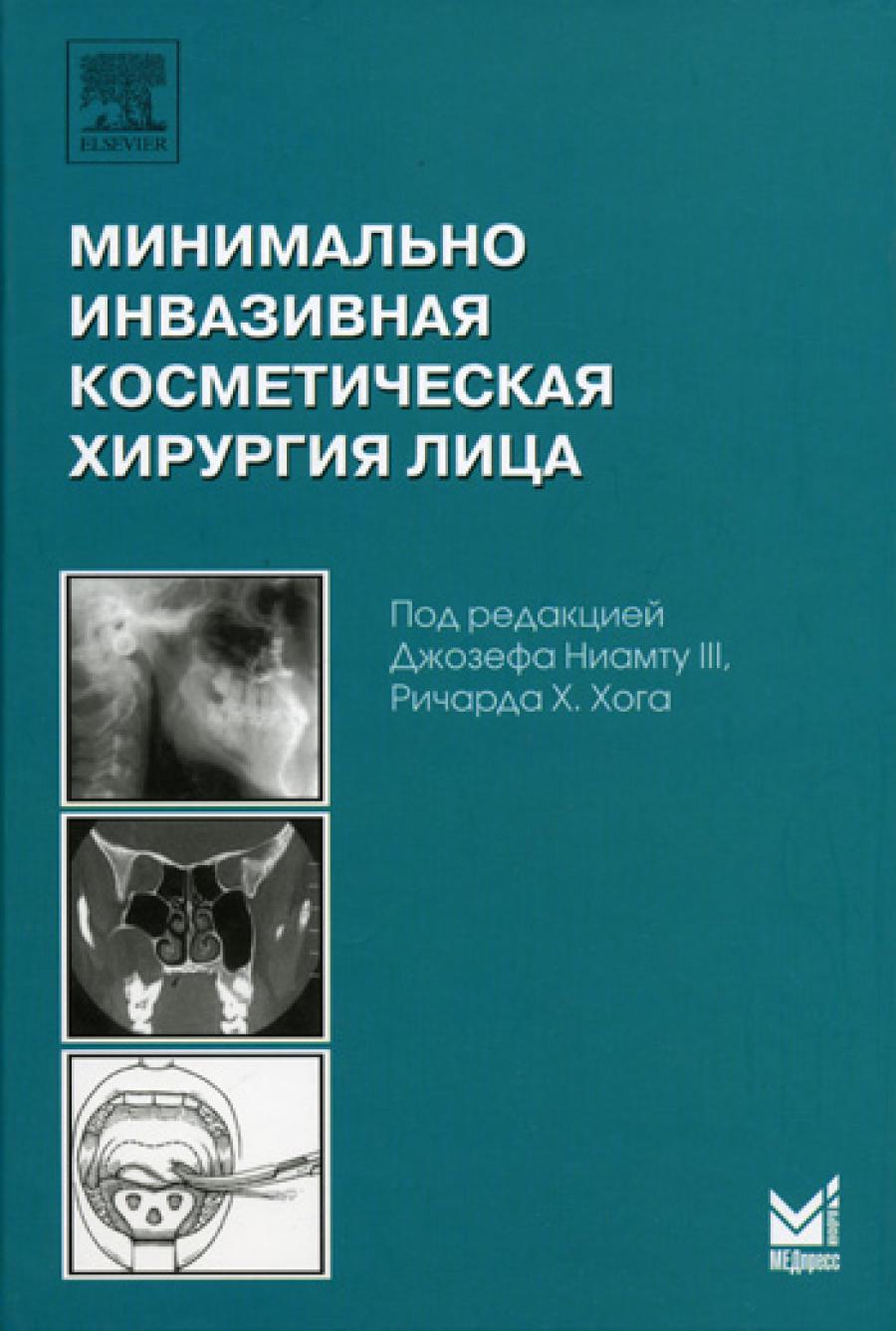 Минимально инвазивная косметическая хирургия. Под ред. Дж.Ниамту III, Р.Хога