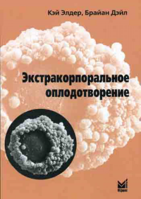 Экстракорпоральное оплодотворение. Элдер К., Дэйл Б.