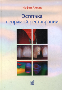 Эстетика непрямой реставрации. Ахмад И.