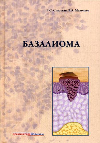 Базалиома. Молочков В.А., Снарская Е.С.