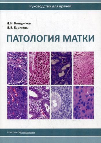 Патология матки. Руководство для врачей. 2-е изд. Кондриков Н.И., Баринова И.В.