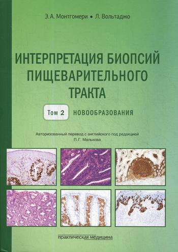 Интерпретация биопсий пищеварительного тракта. Т. 2: Новообразования