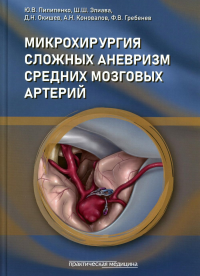 Микрохирургия сложных аневризм средних мозговых артерий: гигантских, фузиформных и частично тромбированных. Элиава Ш.Ш., Пилипенко Ю.В., Окишев Д.Н.