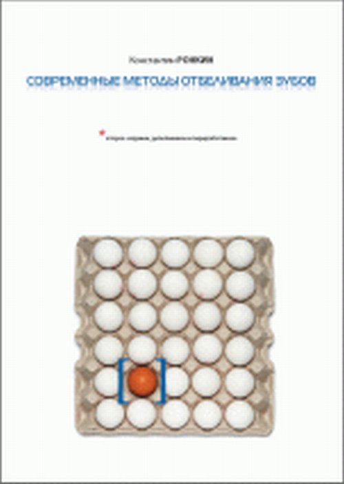 Современные методы отбеливания зубов. Ронкин К.