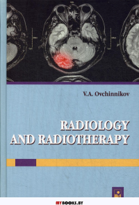 Лучевая диагностика и лучевая терапия = Radiology and radiotherapy: Учебник для студентов факультета иностранных учащихся с английским языком обучения