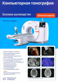 Компьютерная томография. Базовое руководство. 4-е изд., перераб. и доп. Хофер М.