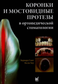 Коронки и мостовидные протезы в ортопедической стоматологии. Смит Б.